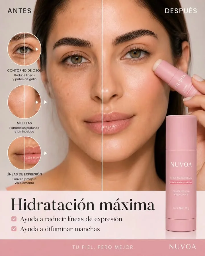 Estructura de anuncio estático: Antes y después