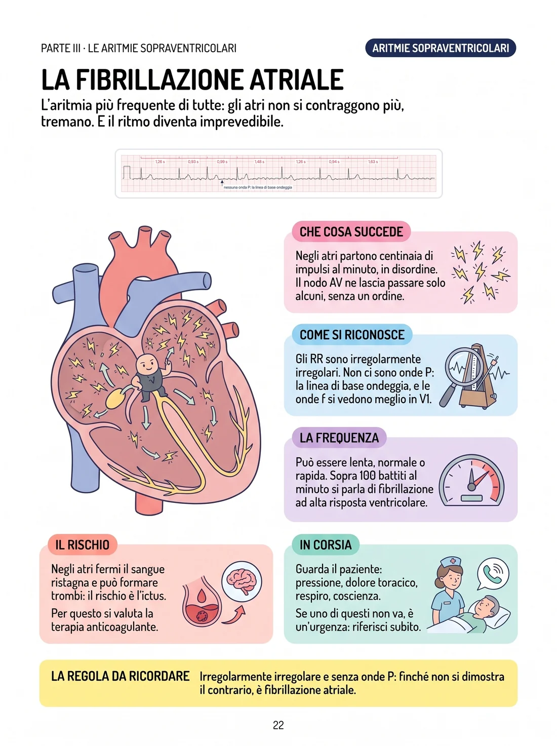 La fibrillazione atriale