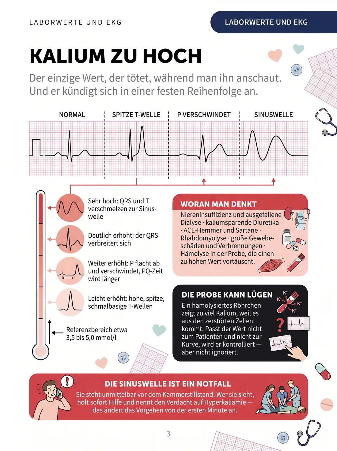 Die Hyperkaliämie im EKG