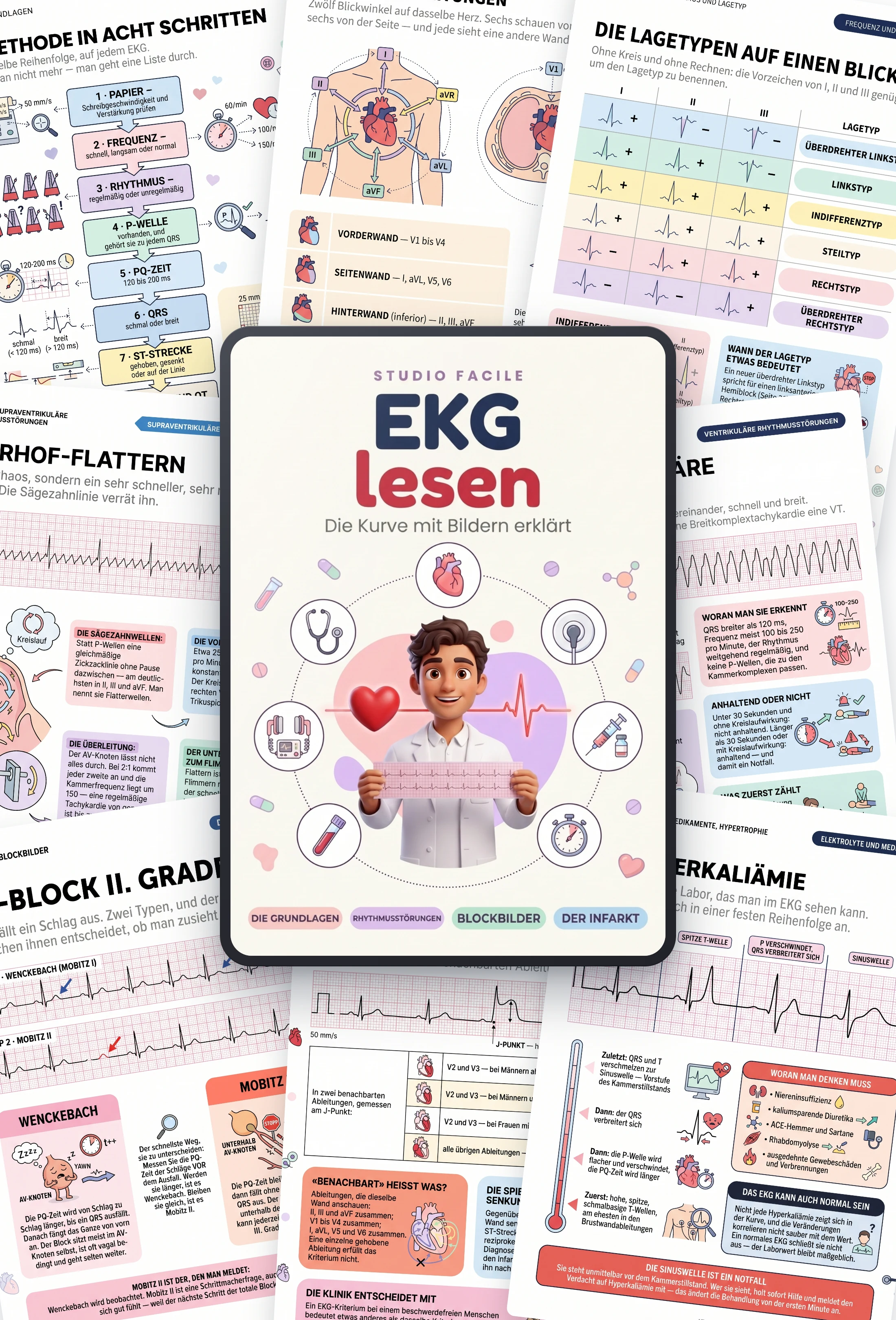 EKG lesen: mockup con pagine di esempio